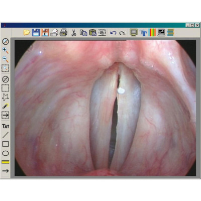 Microscopio OP-Dent 5