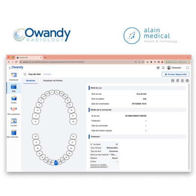 Descubre la Vanguardia en Diagnóstico Dental con Owandy IOS: Escáner I