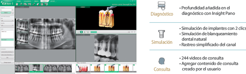 EZDENT-I: SOFTWARE DE IMAGEN DENTAL RÁPIDO Y FÁCIL