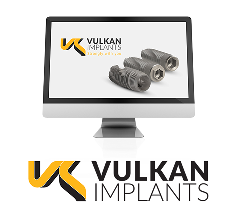 Vulkan Implants